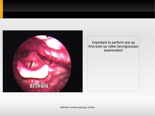 Malignant lesions involving larynx 