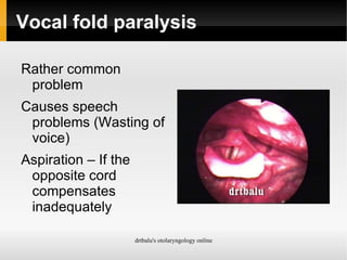Vocal fold paralysis Rather common problem 
