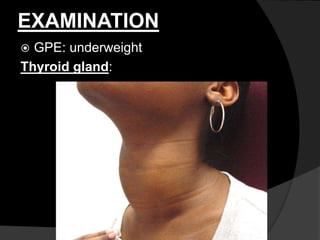 EXAMINATION
 GPE: underweight
Thyroid gland:
 