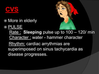 CVS
 More in elderly
 PULSE
Rate : Sleeping pulse up to 100 – 120/ min
Character : water - hammer character
Rhythm: cardiac arrythmias are
superimposed on sinus tachycardia as
disease progresses.
 