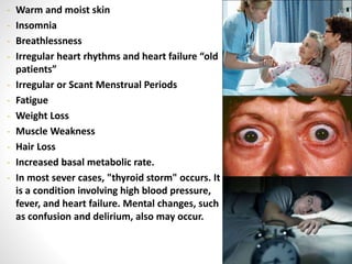 - Warm and moist skin
- Insomnia
- Breathlessness
- Irregular heart rhythms and heart failure “old
patients”
- Irregular or Scant Menstrual Periods
- Fatigue
- Weight Loss
- Muscle Weakness
- Hair Loss
- Increased basal metabolic rate.
- In most sever cases, "thyroid storm" occurs. It
is a condition involving high blood pressure,
fever, and heart failure. Mental changes, such
as confusion and delirium, also may occur.
 