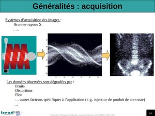 10
Traitement d'Images Médicales, Arnaud Charnoz, Ircad R&D 2012-2013
Systèmes d’acquisition des images :
-Scanner rayons X
…..
Les données observées sont dégradées par :
-Bruits
-Distortions
-Flou
-… autres facteurs spécifiques à l’application (e.g. injection de produit de contraste)
…
Généralités : acquisition
 