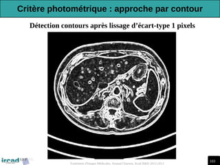 103
Traitement d'Images Médicales, Arnaud Charnoz, Ircad R&D 2012-2013
Détection contours après lissage d’écart-type 1 pixels
Critère photométrique : approche par contour
 