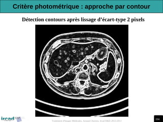 104
Traitement d'Images Médicales, Arnaud Charnoz, Ircad R&D 2012-2013
Détection contours après lissage d’écart-type 2 pixels
Critère photométrique : approche par contour
 