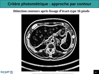 107
Traitement d'Images Médicales, Arnaud Charnoz, Ircad R&D 2012-2013
Détection contours après lissage d’écart-type 16 pixels
Critère photométrique : approche par contour
 