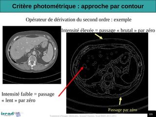 109
Traitement d'Images Médicales, Arnaud Charnoz, Ircad R&D 2012-2013
Opérateur de dérivation du second ordre : exemple
Passage par zéro
Intensité élevée = passage « brutal » par zéro
Intensité faible = passage
« lent » par zéro
Critère photométrique : approche par contour
 