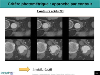 111
Traitement d'Images Médicales, Arnaud Charnoz, Ircad R&D 2012-2013
Contours actifs 2D
Intuitif, réactif
Critère photométrique : approche par contour
 