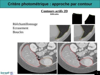 115
Traitement d'Images Médicales, Arnaud Charnoz, Ircad R&D 2012-2013
Contours actifs 2D
Difficultés
-Rééchantillonnage
-Ecrasement
-Boucles
Critère photométrique : approche par contour
 