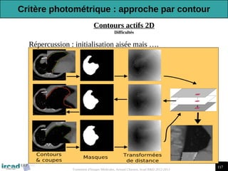 117
Traitement d'Images Médicales, Arnaud Charnoz, Ircad R&D 2012-2013
Contours actifs 2D
Difficultés
-Répercussion : initialisation aisée mais ….
Critère photométrique : approche par contour
 