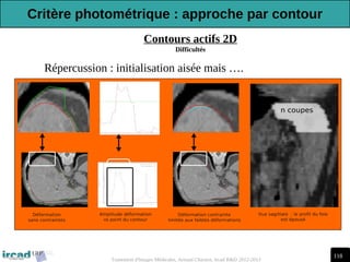 118
Traitement d'Images Médicales, Arnaud Charnoz, Ircad R&D 2012-2013
Contours actifs 2D
Difficultés
-Répercussion : initialisation aisée mais ….
Critère photométrique : approche par contour
 