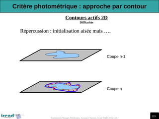 119
Traitement d'Images Médicales, Arnaud Charnoz, Ircad R&D 2012-2013
Contours actifs 2D
Difficultés
-Répercussion : initialisation aisée mais ….
Coupe n-1
Coupe n
Critère photométrique : approche par contour
 