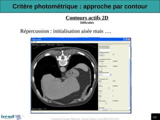 120
Traitement d'Images Médicales, Arnaud Charnoz, Ircad R&D 2012-2013
Contours actifs 2D
Difficultés
-Répercussion : initialisation aisée mais ….
Critère photométrique : approche par contour
 