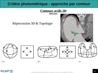 121
Traitement d'Images Médicales, Arnaud Charnoz, Ircad R&D 2012-2013
Contours actifs 2D
Difficultés
-Répercussion 3D & Topologie
Critère photométrique : approche par contour
 