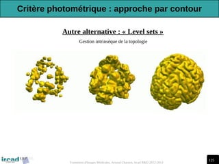 125
Traitement d'Images Médicales, Arnaud Charnoz, Ircad R&D 2012-2013
Autre alternative : « Level sets »
Gestion intrinsèque de la topologie
Critère photométrique : approche par contour
 