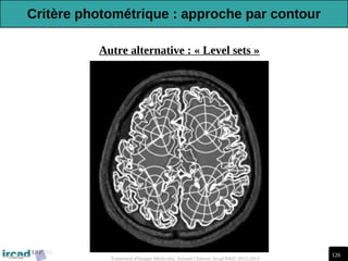 126
Traitement d'Images Médicales, Arnaud Charnoz, Ircad R&D 2012-2013
Autre alternative : « Level sets »
Critère photométrique : approche par contour
 