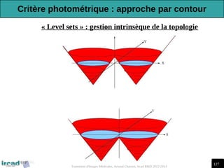 127
Traitement d'Images Médicales, Arnaud Charnoz, Ircad R&D 2012-2013
« Level sets » : gestion intrinsèque de la topologie
Critère photométrique : approche par contour
 