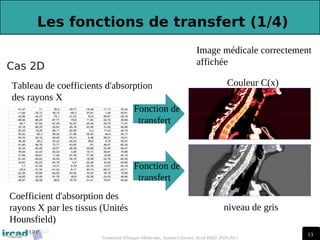 13
13
Traitement d'Images Médicales, Arnaud Charnoz, Ircad R&D 2010-2011
 
Les fonctions de transfert (1/4)
Fonction de
transfert
Image médicale correctement
affichée
Tableau de coefficients d'absorption
des rayons X
niveau de gris
Cas 2D
Coefficient d'absorption des
rayons X par les tissus (Unités
Hounsfield)
Fonction de
transfert
Couleur C(x)
 