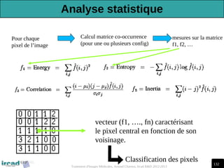 132
Traitement d'Images Médicales, Arnaud Charnoz, Ircad R&D 2012-2013
Pour chaque
pixel de l’image
Calcul matrice co-occurrence
(pour une ou plusieurs config)
vecteur (f1, …., fn) caractérisant
le pixel central en fonction de son
voisinage.
mesures sur la matrice
f1, f2, …
Classification des pixels
Analyse statistique
 