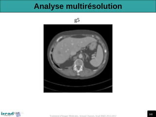 140
Traitement d'Images Médicales, Arnaud Charnoz, Ircad R&D 2012-2013
g5
Analyse multirésolution
 