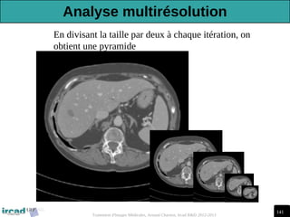 141
Traitement d'Images Médicales, Arnaud Charnoz, Ircad R&D 2012-2013
En divisant la taille par deux à chaque itération, on
obtient une pyramide
Analyse multirésolution
 