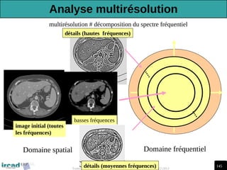 145
Traitement d'Images Médicales, Arnaud Charnoz, Ircad R&D 2012-2013
Domaine spatial Domaine fréquentiel
multirésolution # décomposition du spectre fréquentiel
basses fréquences
détails (moyennes fréquences)
détails (hautes fréquences)
image initial (toutes
les fréquences)
Analyse multirésolution
 