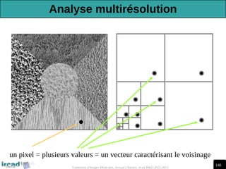 148
Traitement d'Images Médicales, Arnaud Charnoz, Ircad R&D 2012-2013
un pixel = plusieurs valeurs = un vecteur caractérisant le voisinage
Analyse multirésolution
 