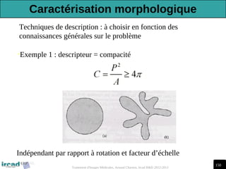 150
Traitement d'Images Médicales, Arnaud Charnoz, Ircad R&D 2012-2013
•Exemple 1 : descripteur = compacité
Techniques de description : à choisir en fonction des
connaissances générales sur le problème
Indépendant par rapport à rotation et facteur d’échelle
Caractérisation morphologique
 