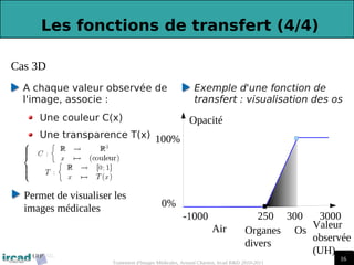 16
16
Traitement d'Images Médicales, Arnaud Charnoz, Ircad R&D 2010-2011
 
Les fonctions de transfert (4/4)
A chaque valeur observée de
l'image, associe :
Une couleur C(x)
Une transparence T(x)
Permet de visualiser les
images médicales
Exemple d'une fonction de
transfert : visualisation des os
Os
250
Opacité
100%
0%
-1000
Valeur
observée
(UH)
Organes
divers
Air
Cas 3D
3000
300
 
