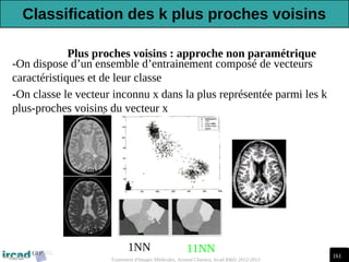161
Traitement d'Images Médicales, Arnaud Charnoz, Ircad R&D 2012-2013
Plus proches voisins : approche non paramétrique
1NN 11NN
-On dispose d’un ensemble d’entrainement composé de vecteurs
caractéristiques et de leur classe
-On classe le vecteur inconnu x dans la plus représentée parmi les k
plus-proches voisins du vecteur x
Classification des k plus proches voisins
 