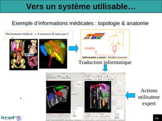 168
Traitement d'Images Médicales, Arnaud Charnoz, Ircad R&D 2012-2013
Exemple d’informations médicales : topologie & anatomie
0
1 2
3
3
0
1 4
Information a priori : Modèle structurel
residue
Dictionnaire médical : « A recouvre B mais pas C
»
0
1 2
3
4
Traduction informatique
Actions
utilisateur
expert
Vers un système utilisable…
 