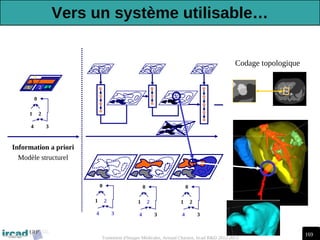 169
Traitement d'Images Médicales, Arnaud Charnoz, Ircad R&D 2012-2013
0
1 2
3
4
0
1 2
4 3
0
1 2
4 3
0
1 2
4 3
0
1 2
4 3
Information a priori
Modèle structurel
Codage topologique
Vers un système utilisable…
 