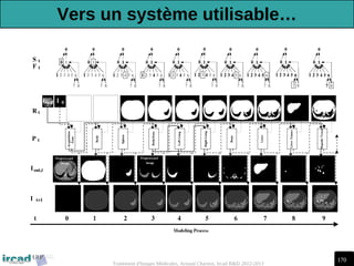 170
Traitement d'Images Médicales, Arnaud Charnoz, Ircad R&D 2012-2013
Vers un système utilisable…
 