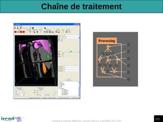 175
Traitement d'Images Médicales, Arnaud Charnoz, Ircad R&D 2012-2013
Processing
Chaîne de traitement
 