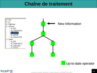176
Traitement d'Images Médicales, Arnaud Charnoz, Ircad R&D 2012-2013
Up-to-date operator
New information
Chaîne de traitement
 