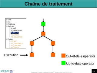 178
Traitement d'Images Médicales, Arnaud Charnoz, Ircad R&D 2012-2013
Out-of-date operator
Up-to-date operator
Execution
Chaîne de traitement
 