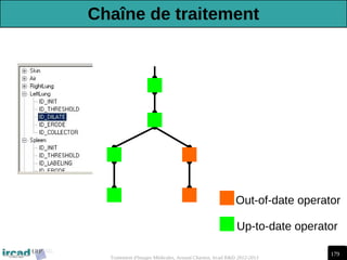 179
Traitement d'Images Médicales, Arnaud Charnoz, Ircad R&D 2012-2013
Out-of-date operator
Up-to-date operator
Chaîne de traitement
 