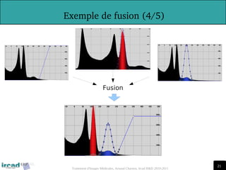 21
21
Traitement d'Images Médicales, Arnaud Charnoz, Ircad R&D 2010-2011
 
Exemple de fusion (4/5)
Fusion
 