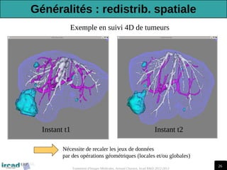 26
Traitement d'Images Médicales, Arnaud Charnoz, Ircad R&D 2012-2013
Exemple en suivi 4D de tumeurs
Nécessite de recaler les jeux de données
par des opérations géométriques (locales et/ou globales)
Instant t1 Instant t2
Généralités : redistrib. spatiale
 