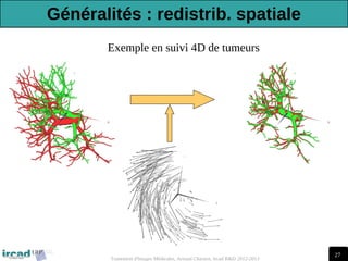 27
Traitement d'Images Médicales, Arnaud Charnoz, Ircad R&D 2012-2013
Exemple en suivi 4D de tumeurs
Généralités : redistrib. spatiale
 