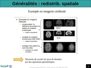 28
Traitement d'Images Médicales, Arnaud Charnoz, Ircad R&D 2012-2013
Exemple en imagerie cérébrale
Nécessite de recaler les jeux de données
par des opérations géométriques
Généralités : redistrib. spatiale
 