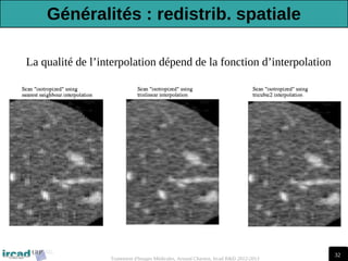 32
Traitement d'Images Médicales, Arnaud Charnoz, Ircad R&D 2012-2013
La qualité de l’interpolation dépend de la fonction d’interpolation
Généralités : redistrib. spatiale
 
