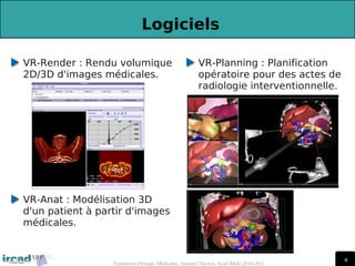 4
4
Traitement d'Images Médicales, Arnaud Charnoz, Ircad R&D 2010-2011
 
Logiciels
VR-Render : Rendu volumique
2D/3D d'images médicales.
VR-Planning : Planification
opératoire pour des actes de
radiologie interventionnelle.
VR-Anat : Modélisation 3D
d'un patient à partir d'images
médicales.
 