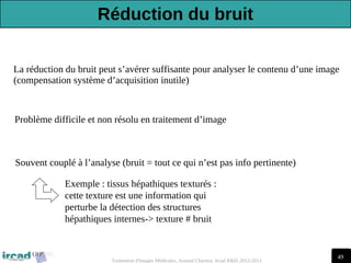 49
Traitement d'Images Médicales, Arnaud Charnoz, Ircad R&D 2012-2013
La réduction du bruit peut s’avérer suffisante pour analyser le contenu d’une image
(compensation système d’acquisition inutile)
Problème difficile et non résolu en traitement d’image
Souvent couplé à l’analyse (bruit = tout ce qui n’est pas info pertinente)
Exemple : tissus hépathiques texturés :
cette texture est une information qui
perturbe la détection des structures
hépathiques internes-> texture # bruit
Réduction du bruit
 