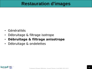 55
Traitement d'Images Médicales, Arnaud Charnoz, Ircad R&D 2012-2013
Restauration d'images
• Généralités
• Débruitage & filtrage isotrope
• Débruitage & filtrage anisotrope
• Débruitage & ondelettes
 