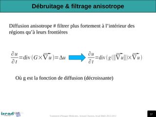 57
Traitement d'Images Médicales, Arnaud Charnoz, Ircad R&D 2012-2013
∂u
∂ t
=div G×
∇ u =Δu
Diffusion anisotrope # filtrer plus fortement à l’intérieur des
régions qu’à leurs frontières
∂u
∂t
=divg∥
∇ u∥×
∇ u 
Où g est la fonction de diffusion (décroissante)
Débruitage & filtrage anisotrope
 