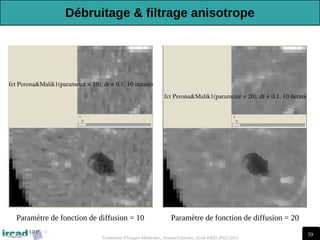 59
Traitement d'Images Médicales, Arnaud Charnoz, Ircad R&D 2012-2013
Paramètre de fonction de diffusion = 10 Paramètre de fonction de diffusion = 20
Débruitage & filtrage anisotrope
 