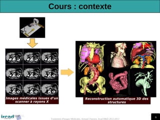 6
Traitement d'Images Médicales, Arnaud Charnoz, Ircad R&D 2012-2013
Reconstruction automatique 3D des
structures
Images médicales issues d’un
scanner à rayons X
Cours : contexte
 