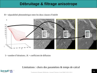 63
Traitement d'Images Médicales, Arnaud Charnoz, Ircad R&D 2012-2013
Limitations : choix des paramètres & temps de calcul
H = séparabilité photométrique entre les deux classes d’intérêt
I = nombre d’itérations ; K = coefficient de diffusion
Débruitage & filtrage anisotrope
 