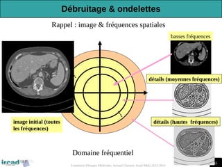 65
Traitement d'Images Médicales, Arnaud Charnoz, Ircad R&D 2012-2013
Rappel : image & fréquences spatiales
Domaine fréquentiel
basses fréquences
détails (moyennes fréquences)
détails (hautes fréquences)
image initial (toutes
les fréquences)
Débruitage & ondelettes
 