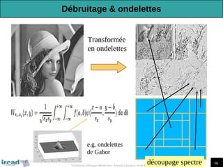 66
Traitement d'Images Médicales, Arnaud Charnoz, Ircad R&D 2012-2013
découpage spectre
Transformée
en ondelettes
e.g. ondelettes
de Gabor
Débruitage & ondelettes
 